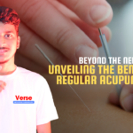 Beyond the Needles: Unveiling the Benefits of Regular Acupuncture